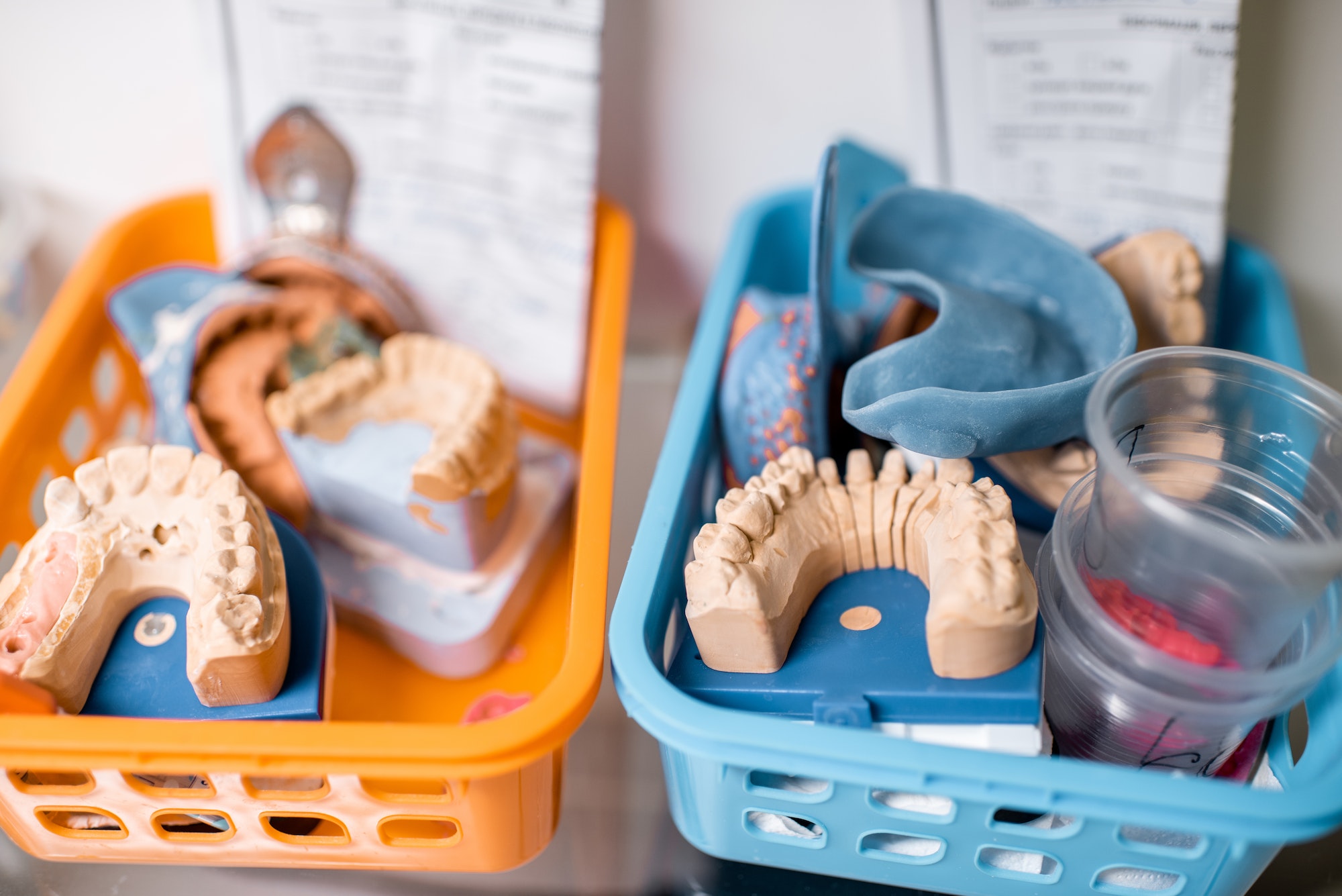 Dental models at the laboratory