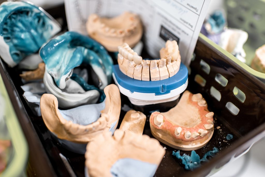 Dental models at the laboratory