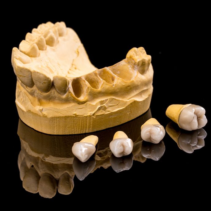 Ceramic dental implants