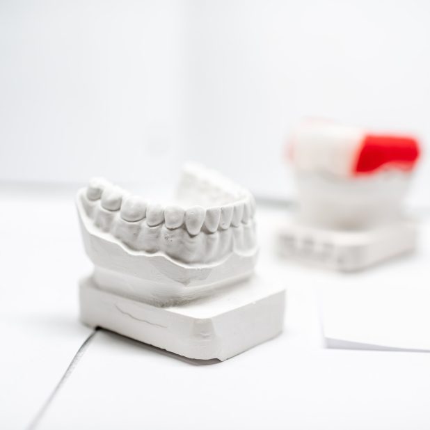 Gypsum models of artificial jaw with dental caps